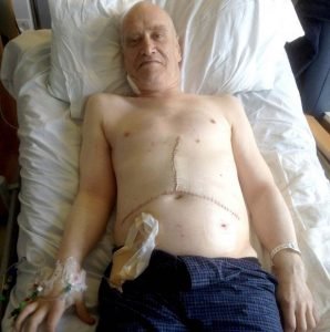 wilko johnson na cama